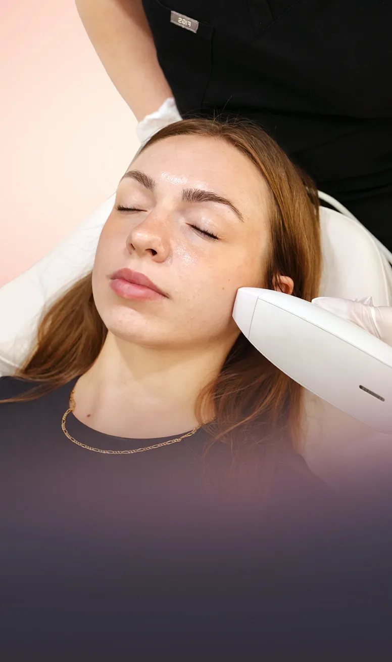 Venus Viva™ Nanofractional RF treatment at Toronto medical spa